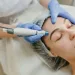 lasersko odstranjevanje dlak zares trajno? Dermatologi razkrivajo resnico o rezultatih, vplivu hormonov in svetujejo, kako doseči gladko kožo, ki traja leta.
